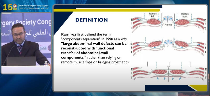 Failure of Components Separation, How To Avoid it
